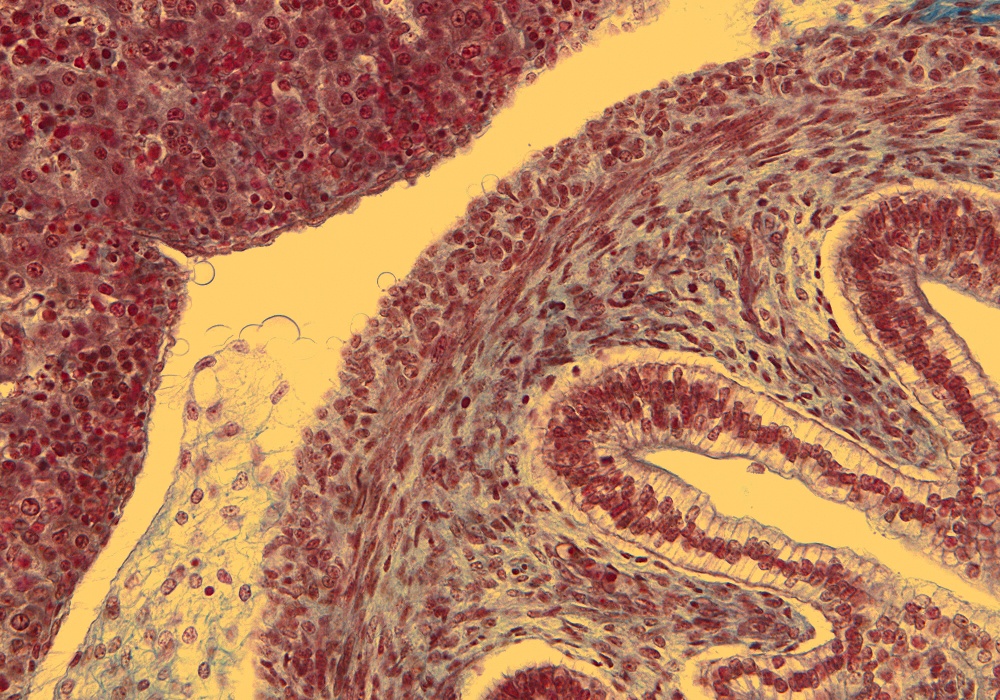 Duodenum Wall