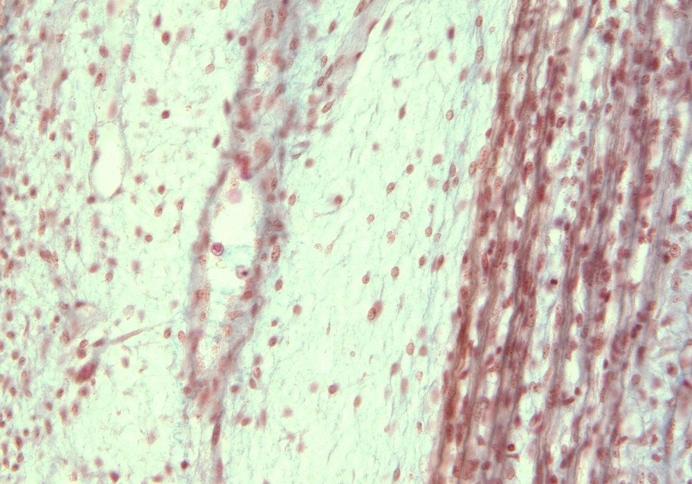 Skeletal Muscle Logitudinal Section, Great Saphenous V.