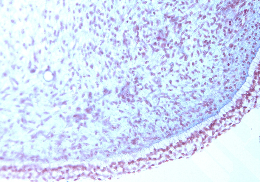 Gubernaculum Testis Lower Part