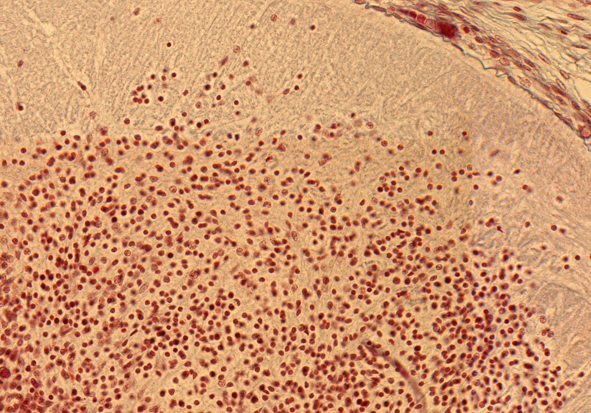 Dorsal Horn in Thoracic Region