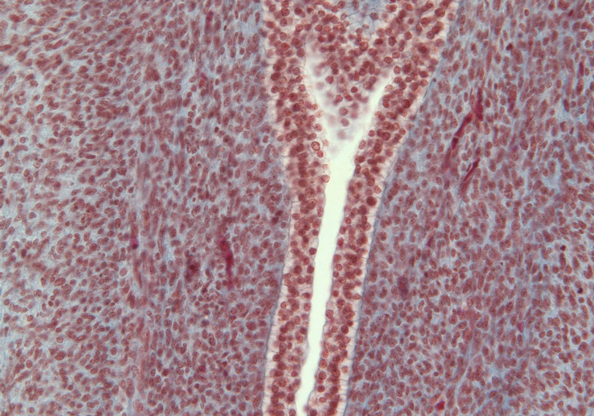 Penile Urethra and Corpus Spongiosum