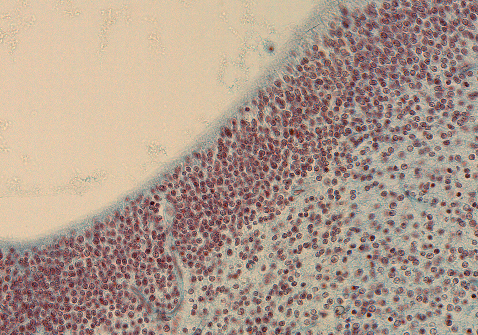 Tegmentum of Mesencephalon - Floor of Cerebral Aqueduct