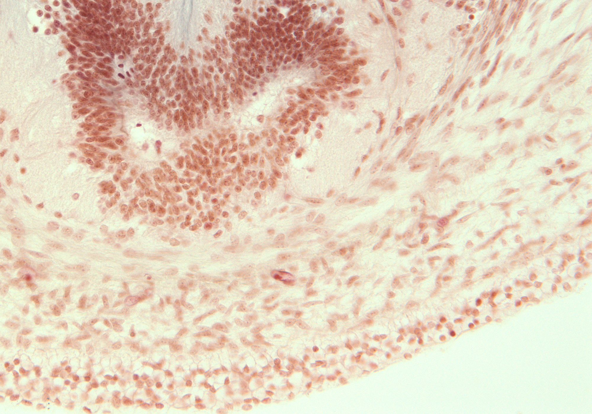 Caudal End of Spinal Cord