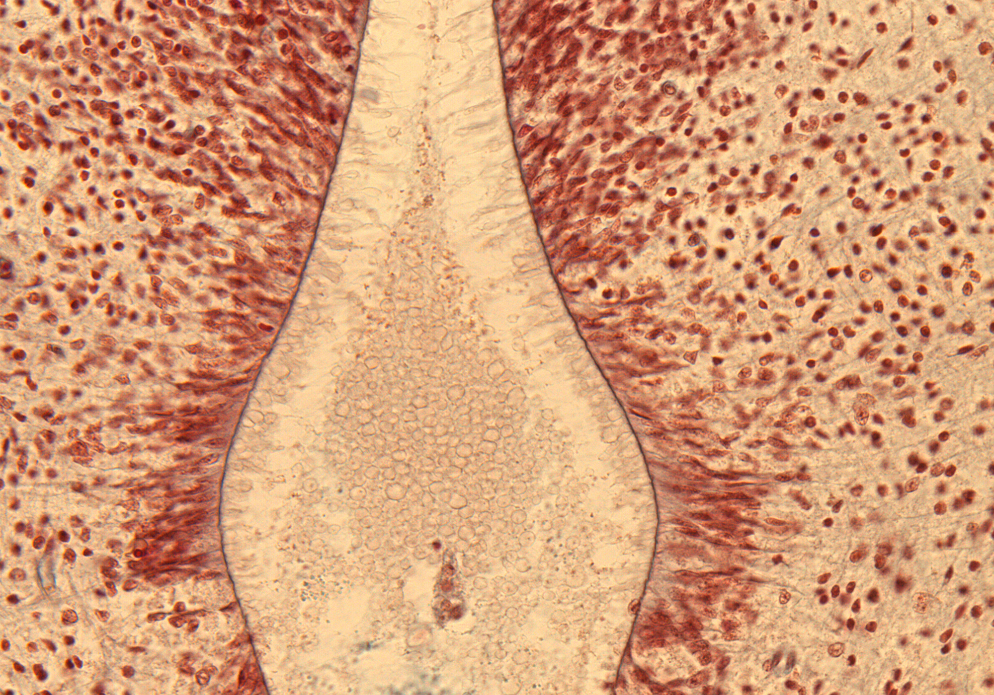 Ventricular Zone in Cervical Region