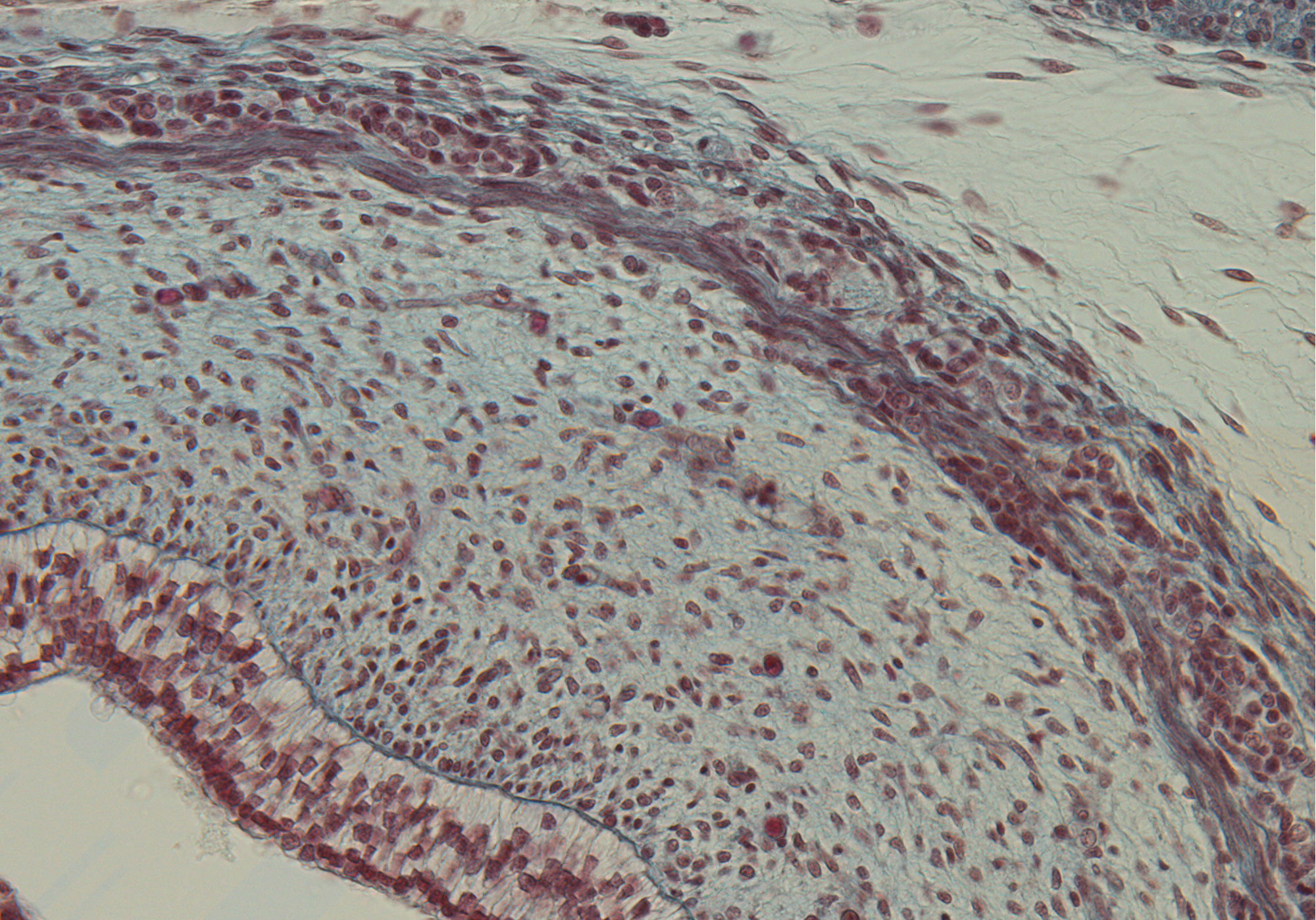 Esophagus Wall in Cervical Region