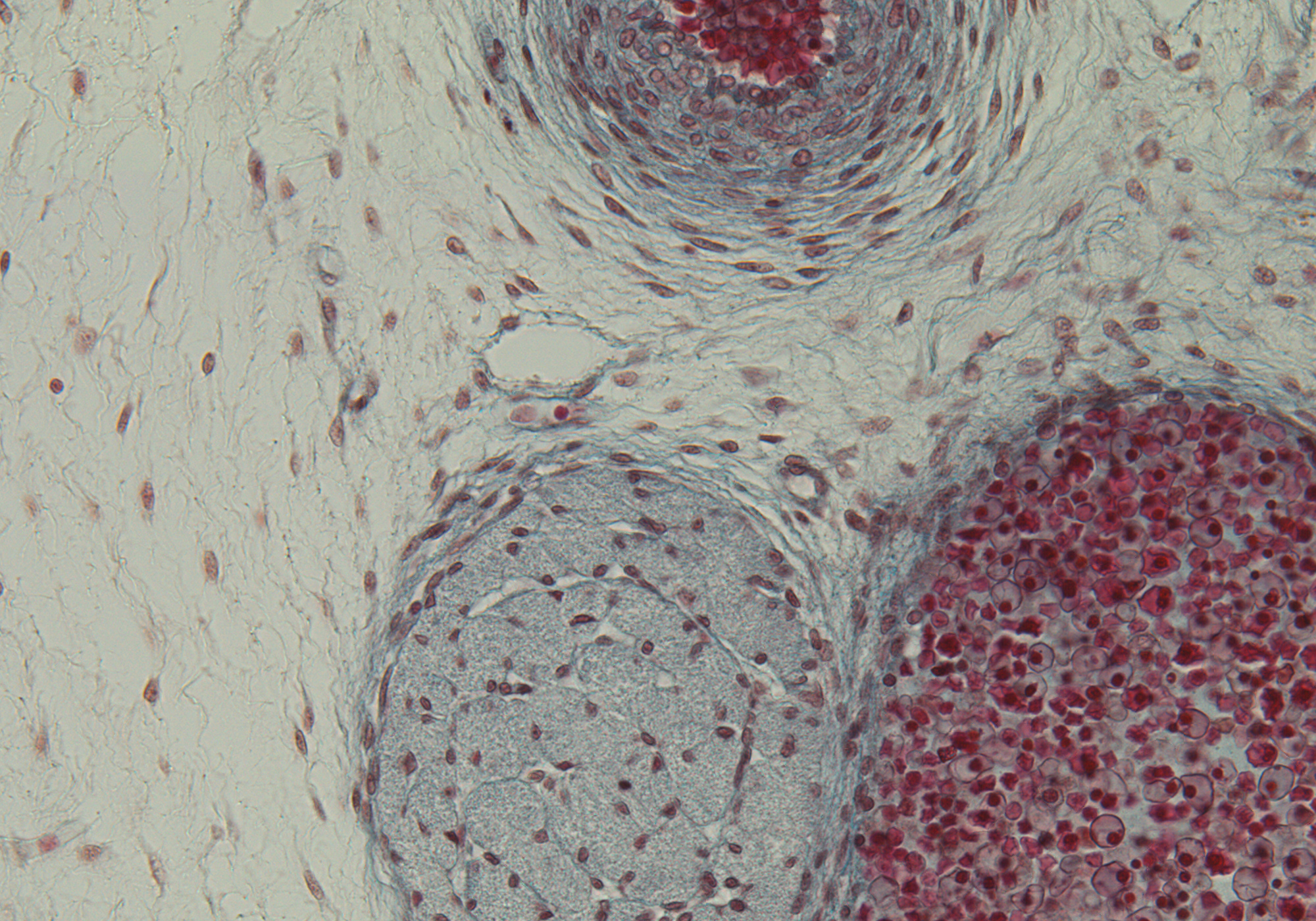 Common Carotid A. Wall, Int. Jugular V. Wall, Vagus N. (CN X)