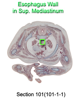 Esophagus Wall in Sup. Mediastinum