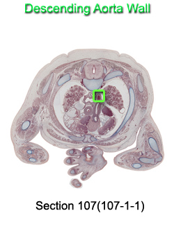 Descending Aorta Wall