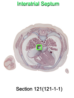 Interatrial Septum