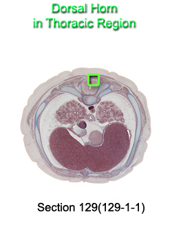 Dorsal Horn in Thoracic Region