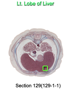 Lt. Lobe of Liver