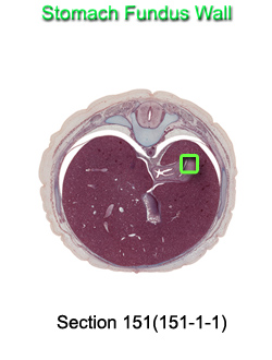 Stomach Fundus Wall