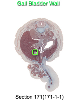 Gall Bladder Wall