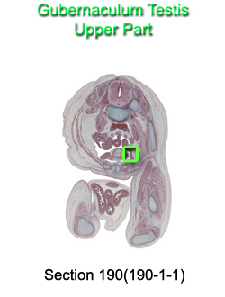 Gubernaculum Testis Upper Part