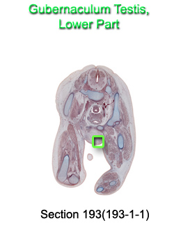 Gubernaculum Testis Lower Part