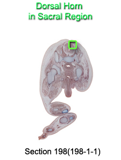 Dorsal Horn in Sacral Region