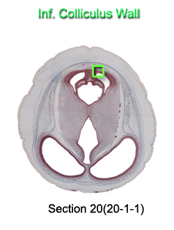 Inf. Colliculus Wall