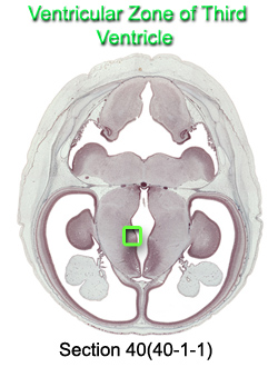 Ventricular Zone of Third Ventricle