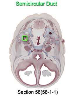 Semicircular Duct