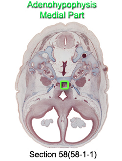 Adenohypophysis Medial Part