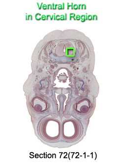 Ventral Horn in Cervical Region