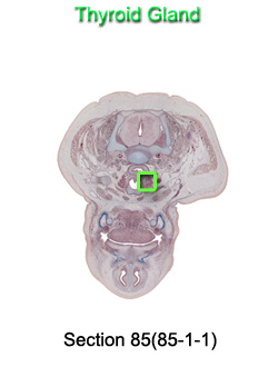 Thyroid Gland