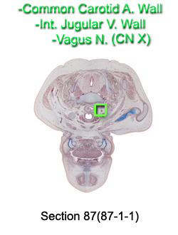 Common Carotid A. Wall, Int. Jugular V. Wall, Vagus N. (CN X)