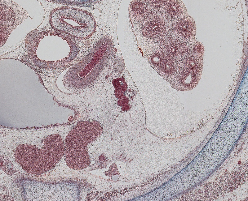 Sup. Mediastinum Aortic Arch and Thymus