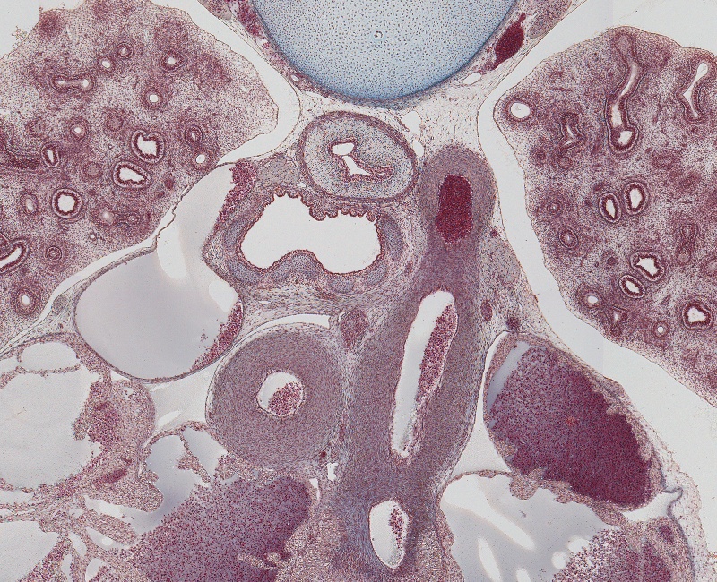 Trachial Bifurcation and Ductus Arteriosus