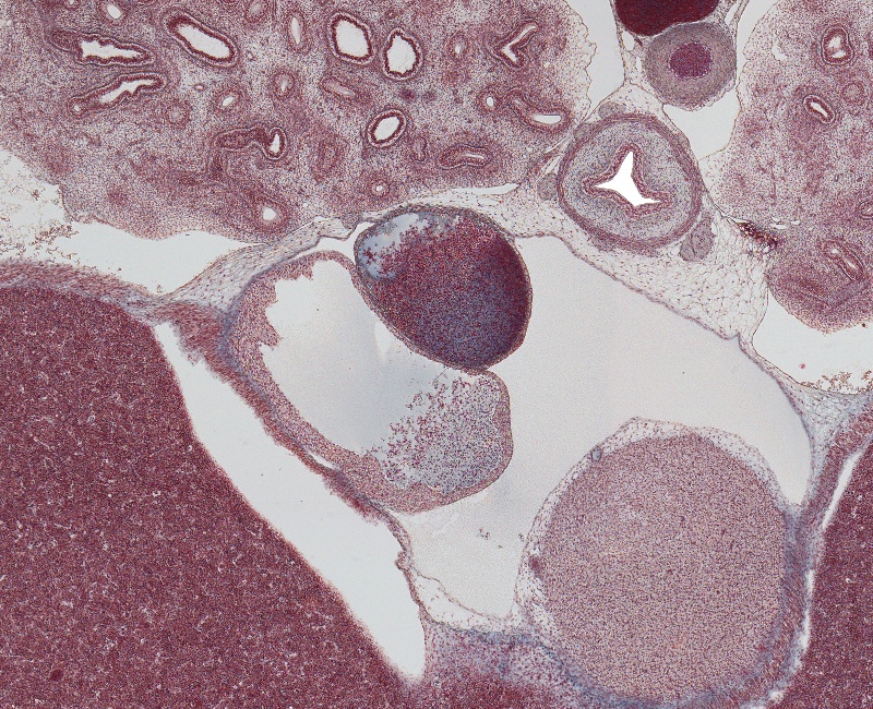 Lower Lobe of Lungs, Lower Part of Rt. Atrium and Lt. Ventricle