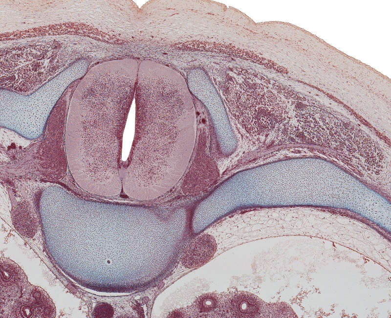 Spinal Cord and Vertebra at T-8