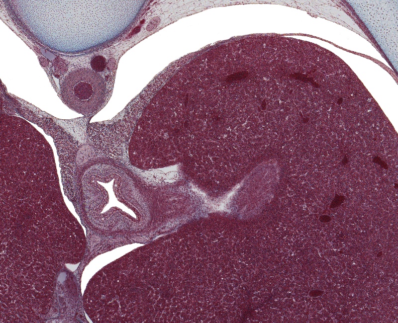 Lower Esophagus, Liver, and Crura of Diaphragm