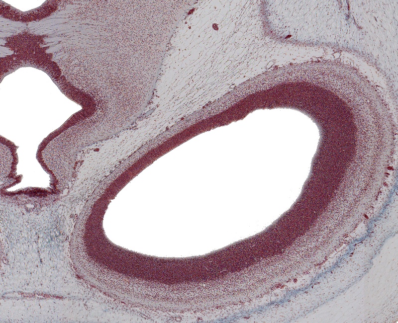 Habenular Commissure and Occipital Lobe Region of Cerebral Hemisphere