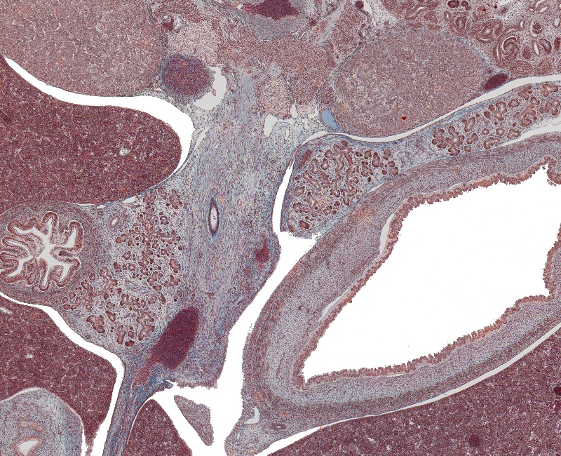 Body of Pancreas, Head of Pancreas, Sup. Mesenteric V, and Lower Supraenal Gland