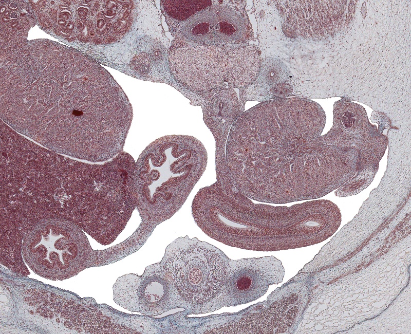 Testes, Colon and Upper Bladder