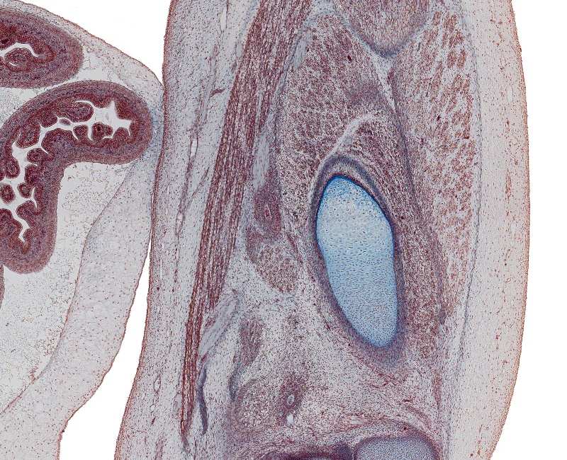 Great SaphenousV., Sartorius M., MM. in Long Sec. and T Sec.