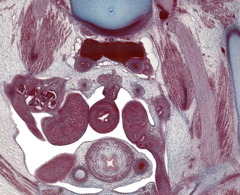 Lower Testis, Upper Gubernaculum Testis, Bladder and Junction of Common Iliac VV.