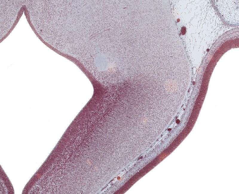 Cerebellum and Tegmentum of Mesencephalon