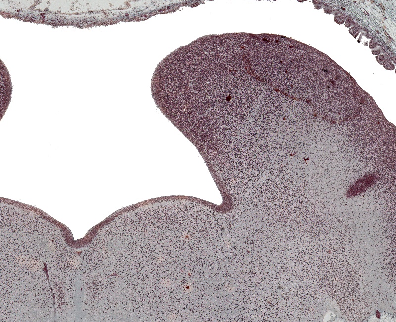 Metencephalon Basal and Alar Plates