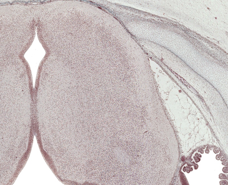 Obex of the Fourth Ventricle and Medulla Oblongata