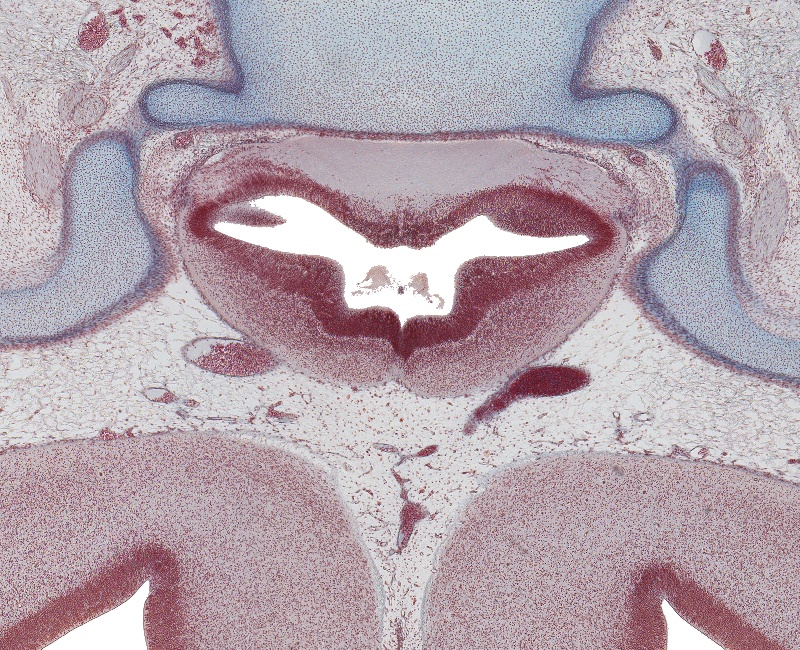 Optic Chiasm