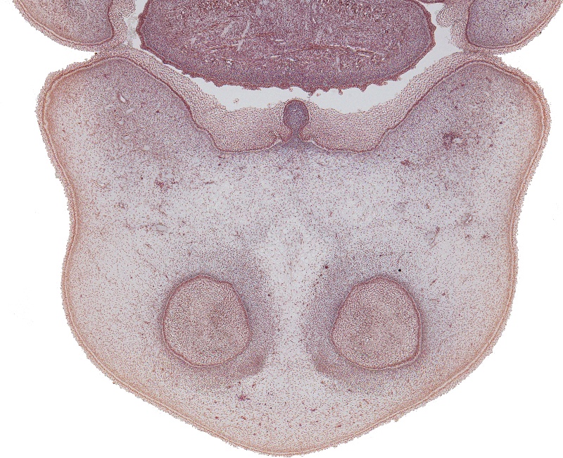 Anterior Tongue, Angle of Mouth and Nose