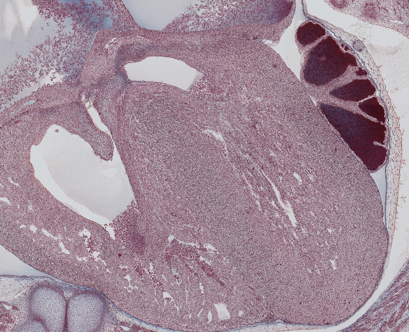 Heart, Lt. and Rt. Ventricles Inverventricular Septum