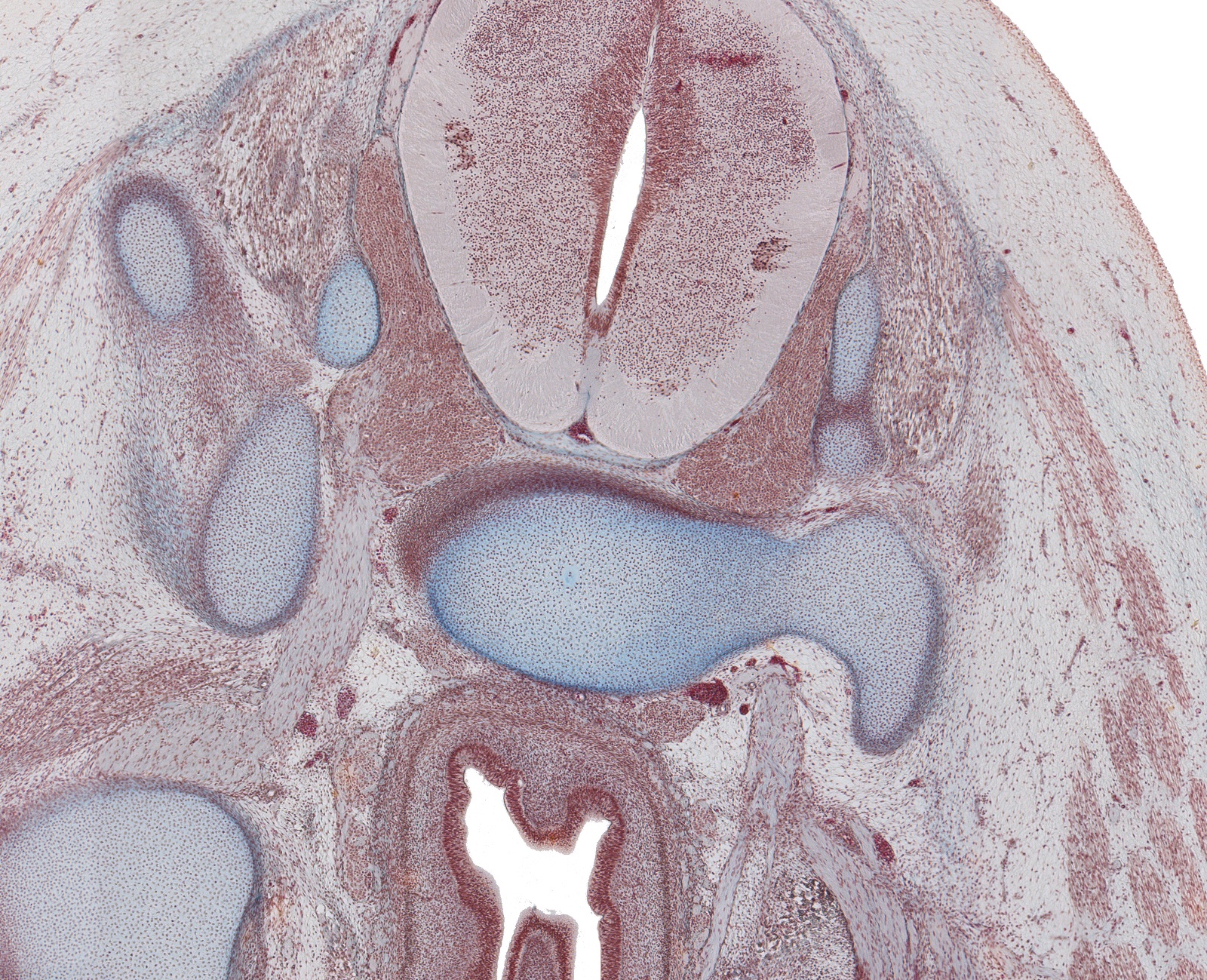 S-2 Spinal Cord, Rectum and Sacral Plexus