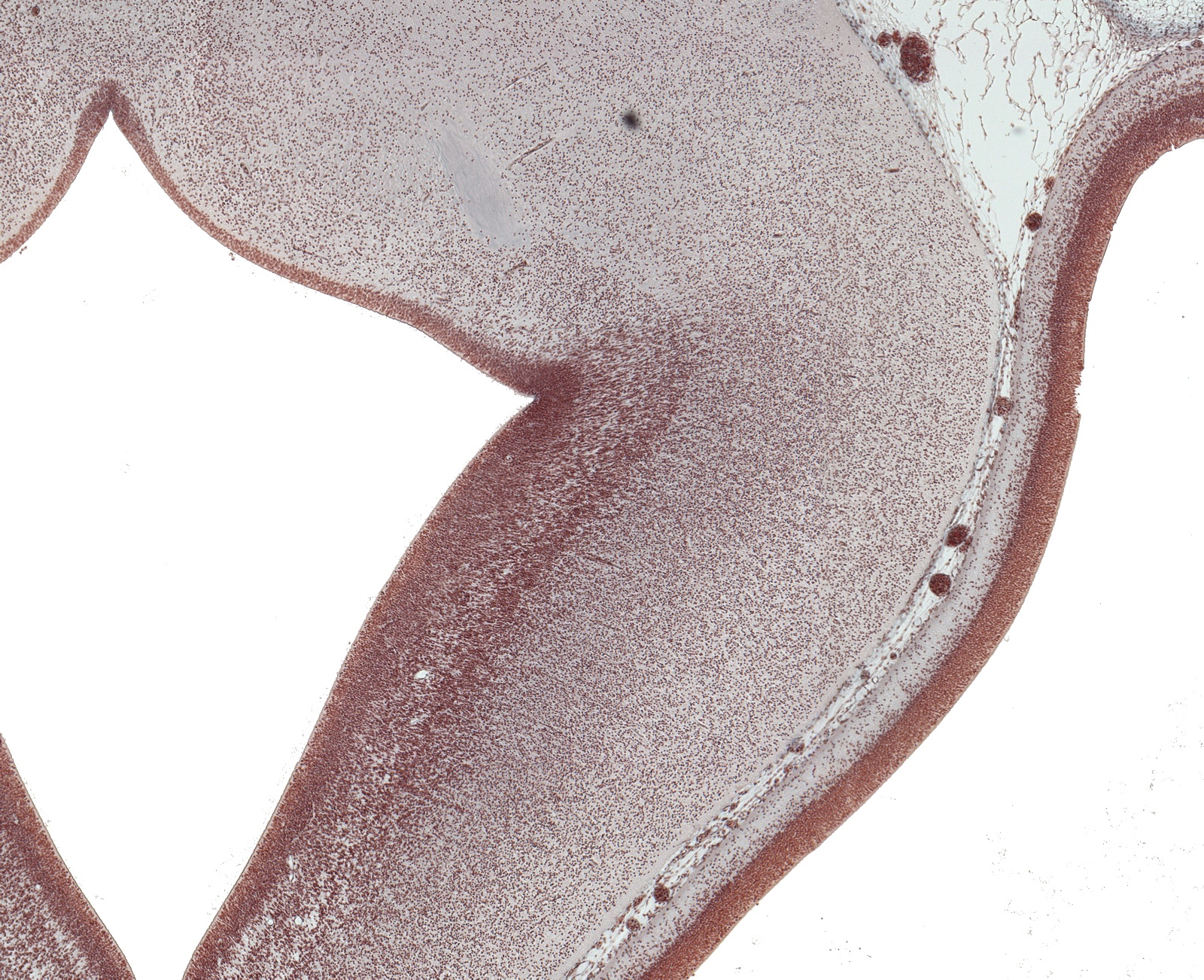 Dorsal Thalamus and Basis Pedunculi