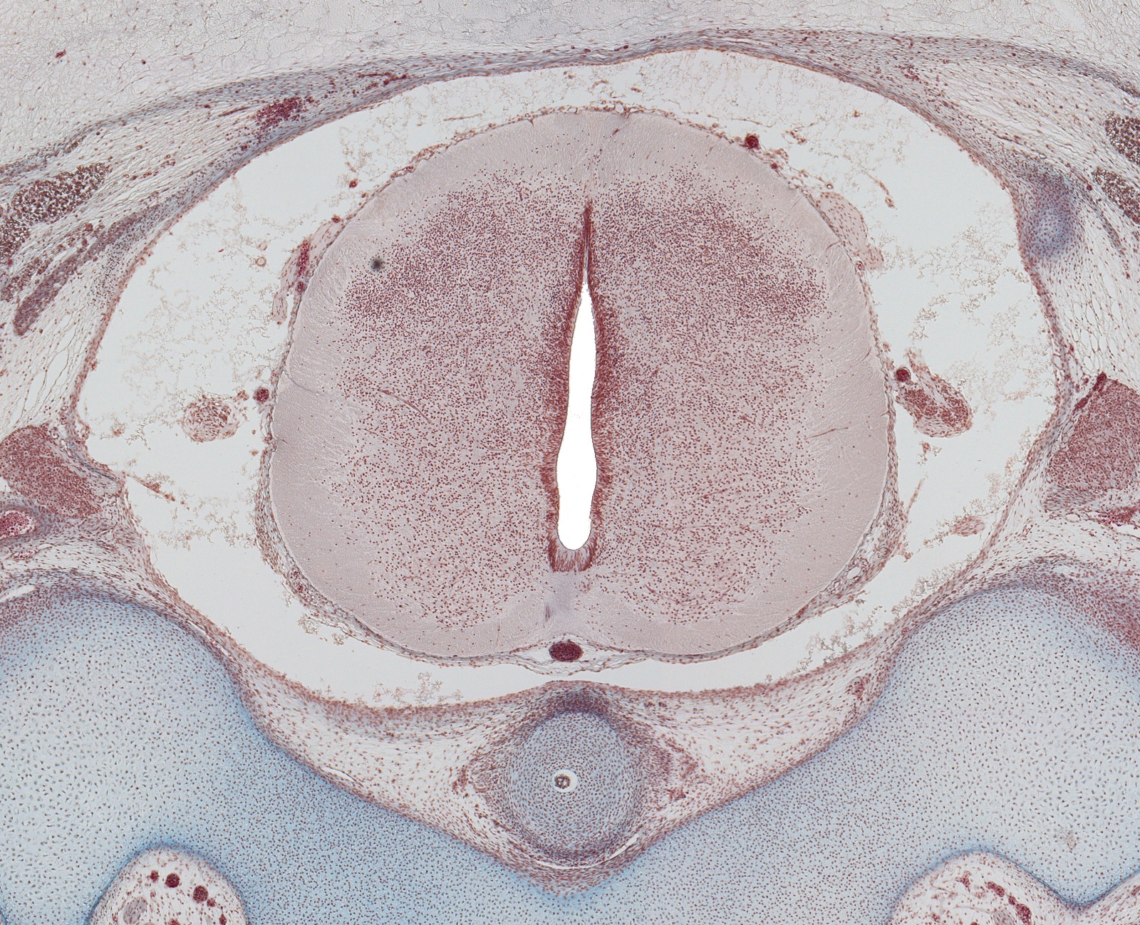 Spinal Cord at C-1