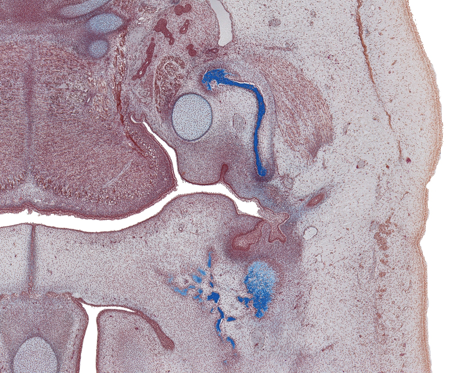 Tongue, Palate, and Mandible