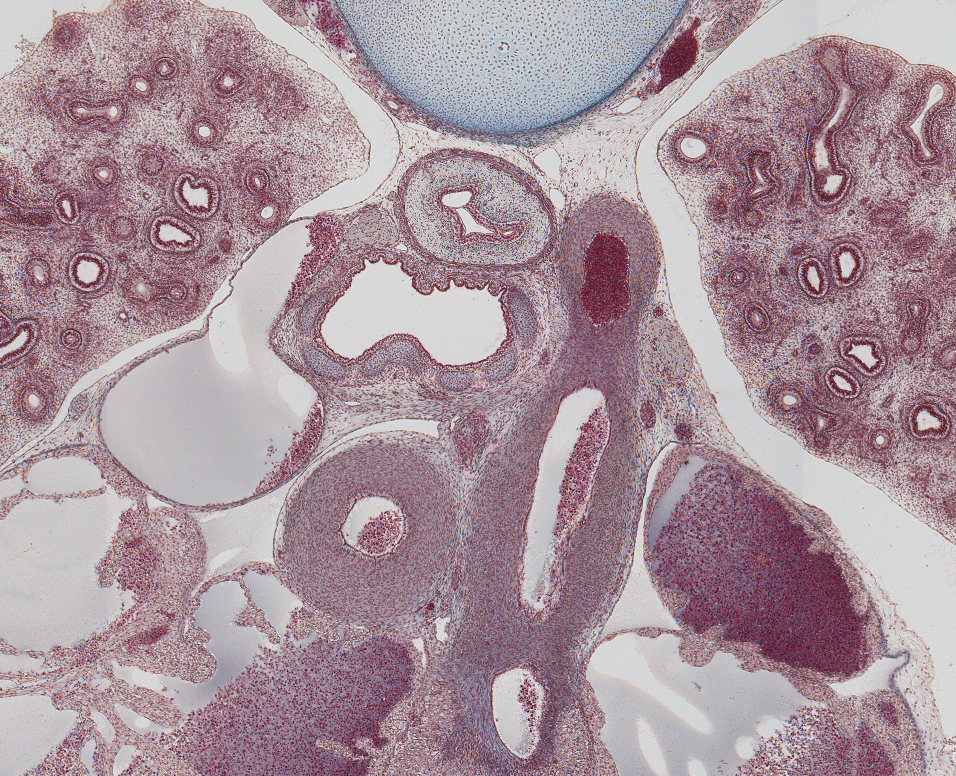 Trachial Bifurcation and Ductus Arteriosus