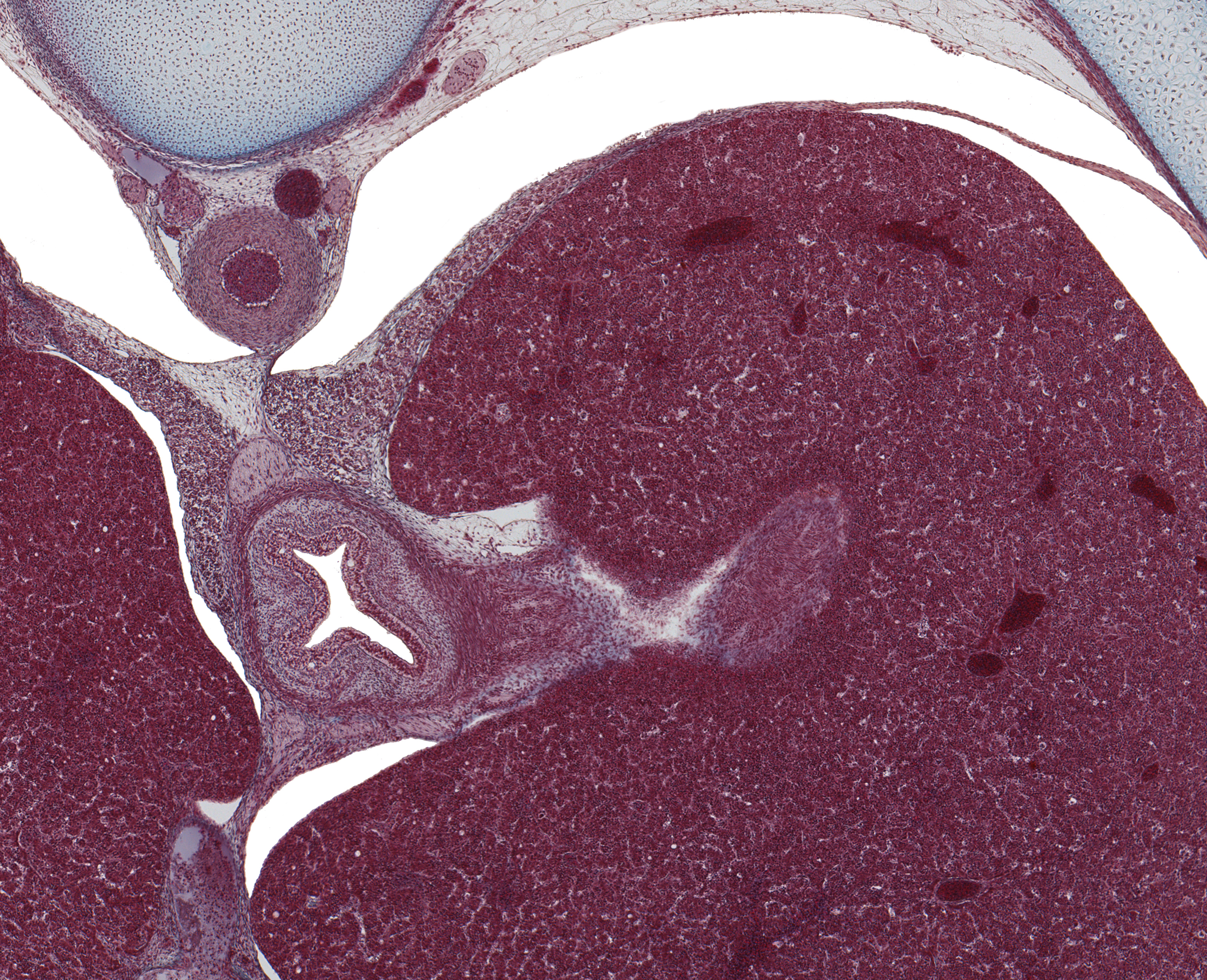 Lower Esophagus, Liver, and Crura of Diaphragm