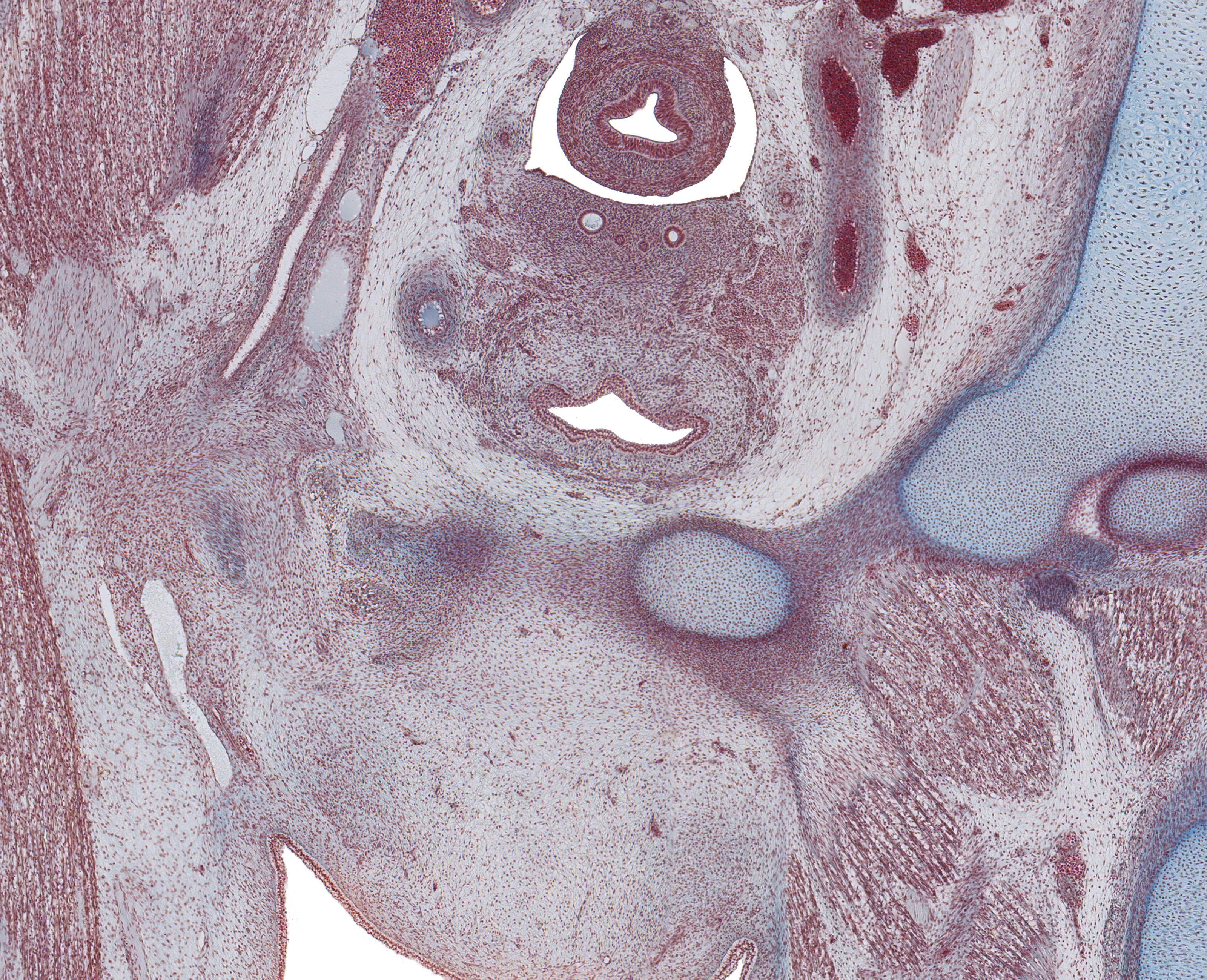 Paramesenephric Ducts, and Gubernaculum Testis in Scrotal Fold